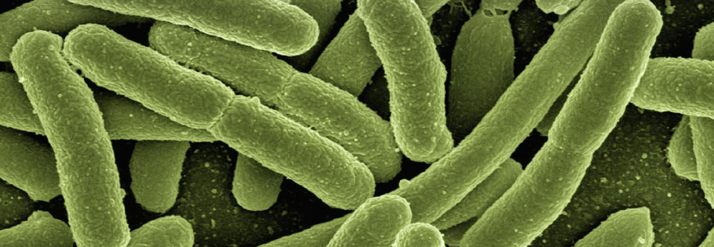 E coli with false colour